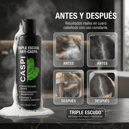 CASPI® | Shampoo Tratante Anticaspa